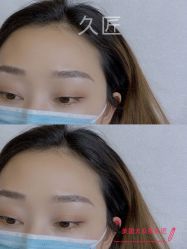 -久匠·纹眉半永久野生眉