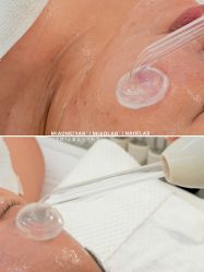 点击看大图 -韩国淼美颜皮肤管理官方直营店