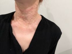 -海涛医疗美容·面部抗衰·注射美鼻