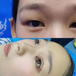 -弘美医美·艾维岚童颜抗衰中心