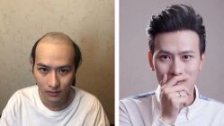 -发饰美男士增发补发假发定制店