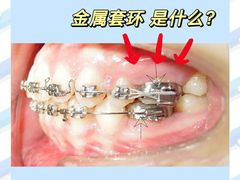 -极光口腔·矫正种植修复(锦江店)