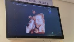 -杭州贝瑞斯美华妇儿医院·早孕·产检·儿科