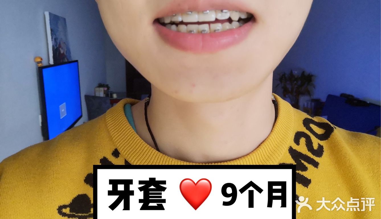 【案例分享】今天我们来讲个小帅哥的正畸案例