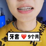 【案例分享】今天我们来讲个小帅哥的正畸案例