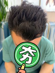 点击看大图 -大麦微针植发全国连锁