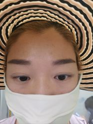 体验后-JUVA欧华医美连锁