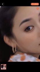 -广州健丽·去眼袋医疗美容机构