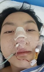 体验后-重庆联合丽格第五医疗美容医院