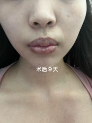 -广州紫馨整形外科医院
