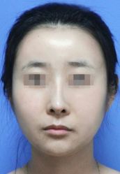 -圣嘉新医疗美容医院