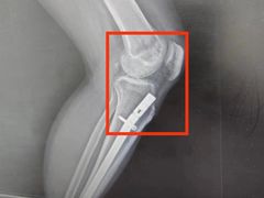 -上海市第一人民医院(松江南部)