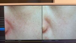 -苑苑vbeauty科技美容SPA