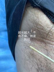 -爱莎扁平疣·汗管瘤·斑痣中心