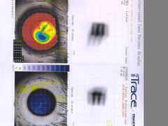 -武汉大学附属爱尔眼科医院(湖北总院)