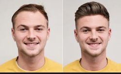 -发饰美男士增发补发假发定制店