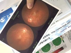 -上海大学附属上海和平眼科医院
