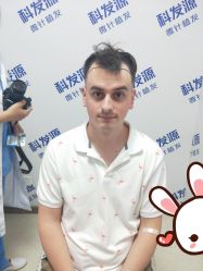 点击看大图 -大麦微针植发丨全国连锁