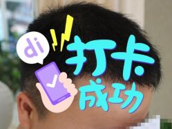 -大麦微针植发全国连锁