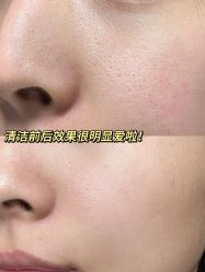 -凡碧诗毛孔清洁收细