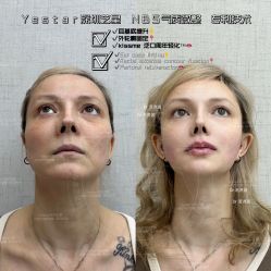 -深圳艺星医疗美容医院