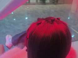 -碧莲盛·不剃发植发