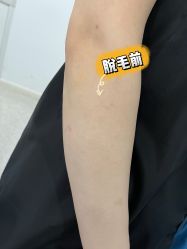 -慕颜医疗美容·皮肤微整 抗衰