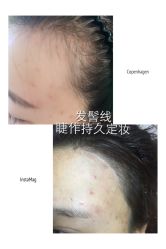 纹绣-光SPA科技美肤