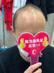 -唐风采假发补发定制