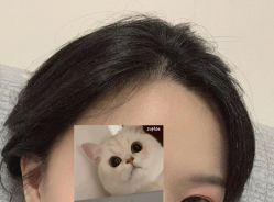 -大麦微针植发全国连锁