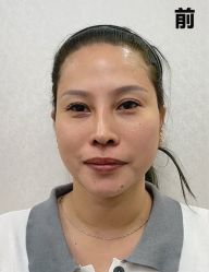 体验前-广州曙光医学美容医院