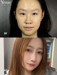 -Yestar艺星整形美容医院