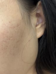 -美瑞莎创美医疗美容
