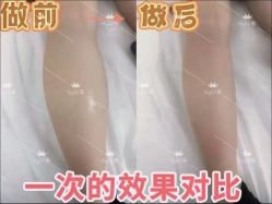 -Lily纤美·科技减脂中心