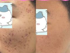 -万达广场(龙湖店)