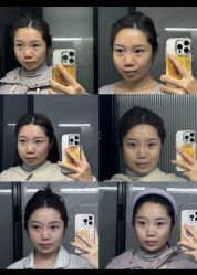 -素美医疗美容·西南眼鼻整形·修复基地