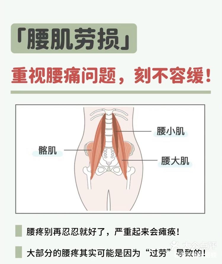 腰部韧带位置图图片