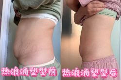 点击看大图 -产后帮产后修复(首城国际店)