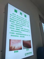 -德哥灰指甲脚气甲沟炎跖疣护理