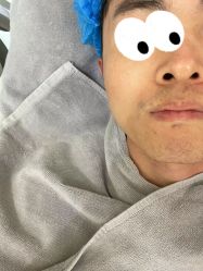 体验前-纯粹医美