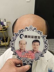 -唐风采假发补发定制