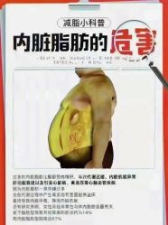 -香薇妮丝·定制减肥·身材管理