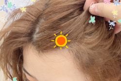 -大麦微针植发全国连锁