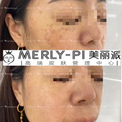 -MLP美丽派·问题肌疗愈中心