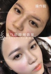 -MLP美丽派·问题肌疗愈中心