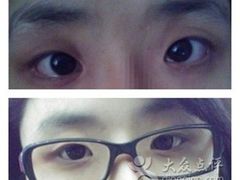 术前-上海华安整形外科门诊部