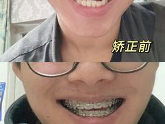 -极光口腔·矫正种植修复(锦江店)