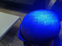 -雍禾植发全国连锁