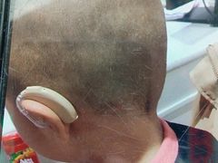 -自然之声助听器·呼吸机(贵定店)