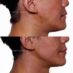 点击看大图 -薇薇安花系SPA